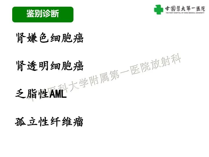 影像PPT - 【病例】肾脏嗜酸细胞腺瘤1例CT影像-28