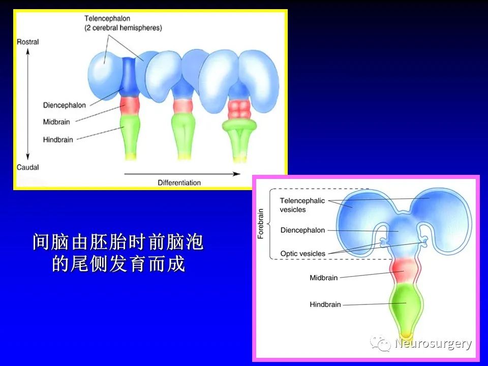 影像PPT - 【PPT】中枢神经系统 间脑-3
