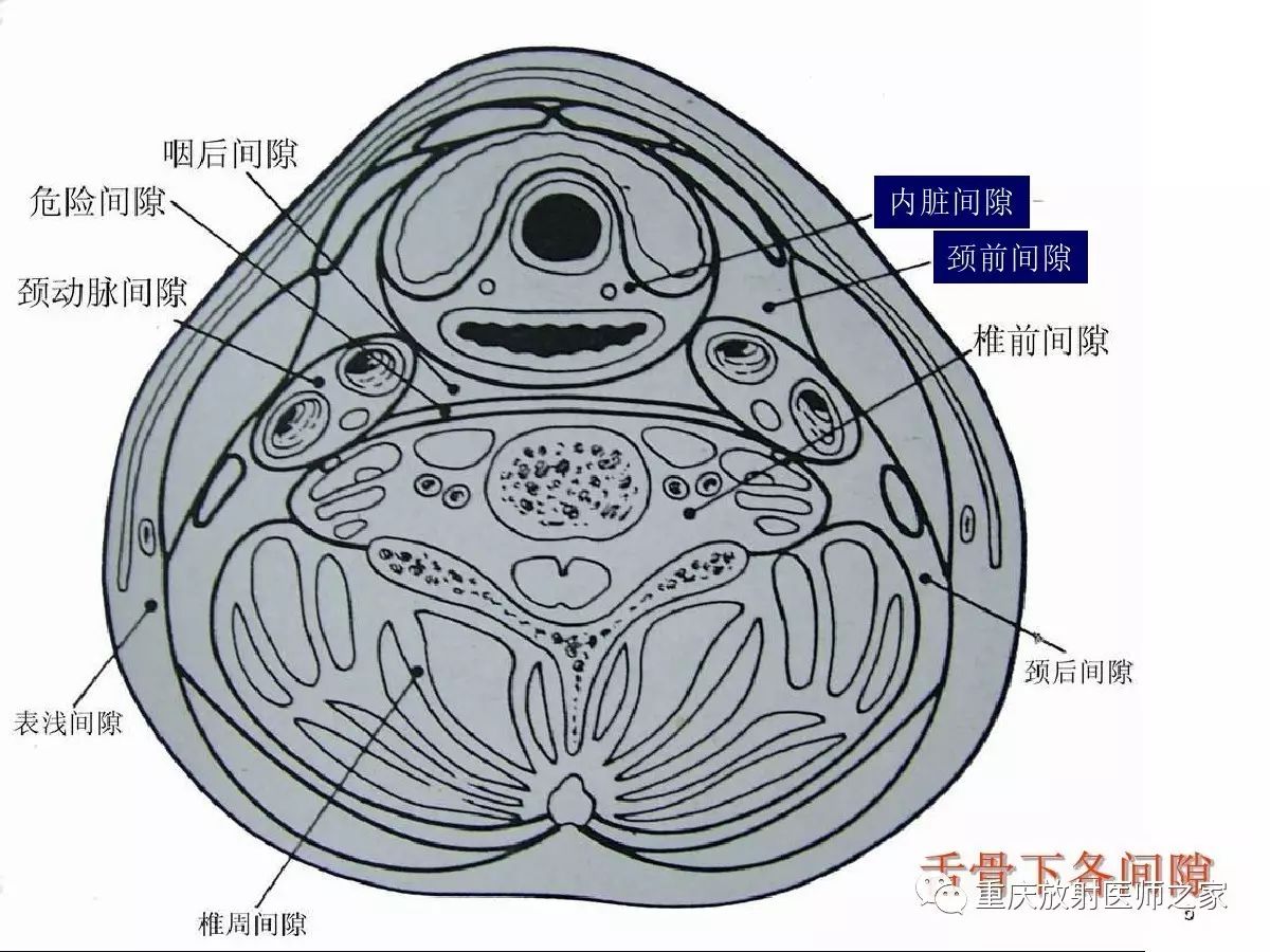 影像PPT - 【PPT】颈部病变的诊断思路-6