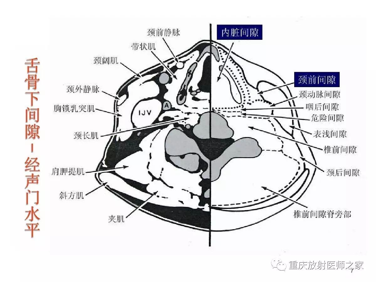影像PPT - 【PPT】颈部病变的诊断思路-7