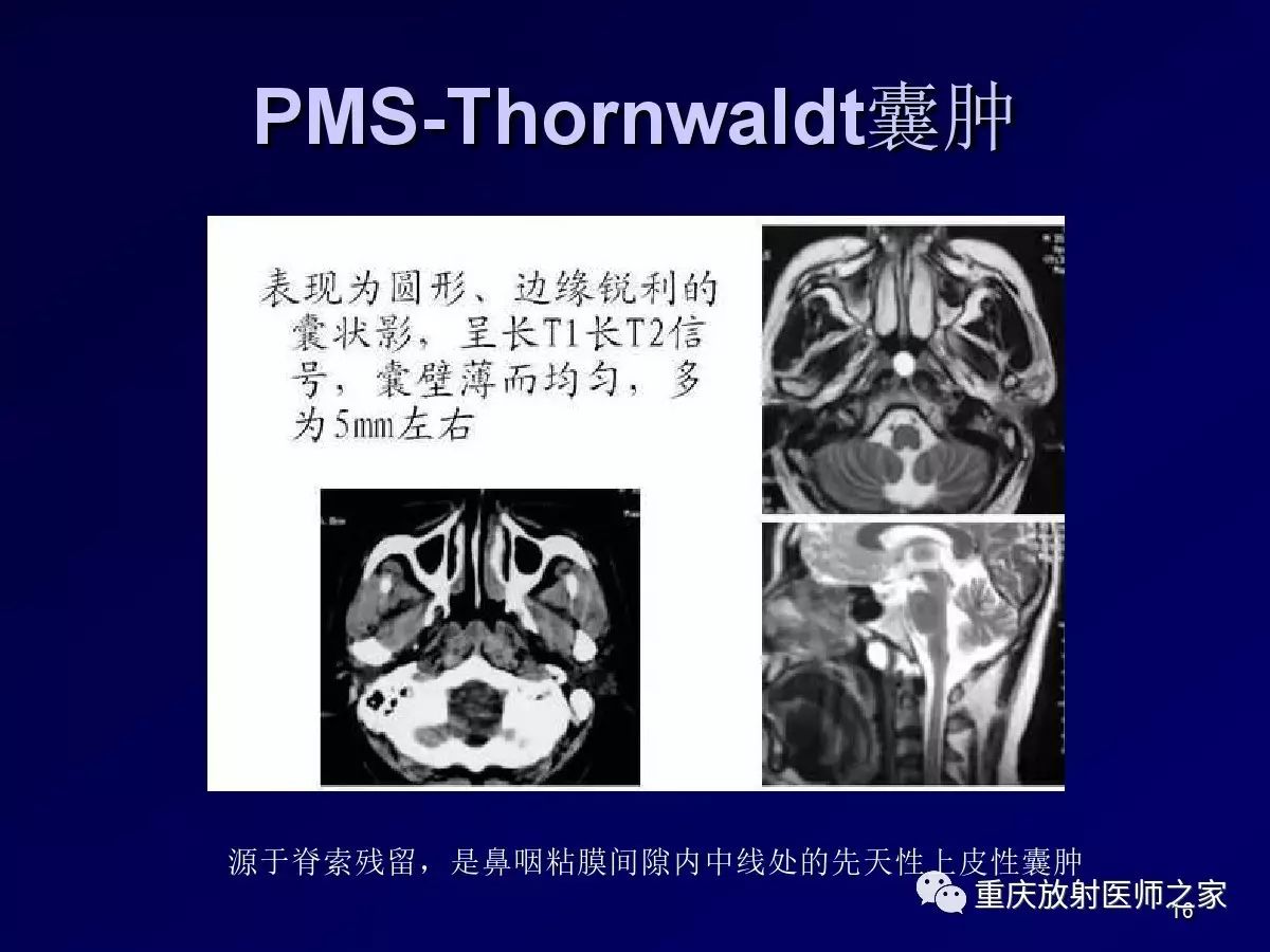 影像PPT - 【PPT】颈部病变的诊断思路-16
