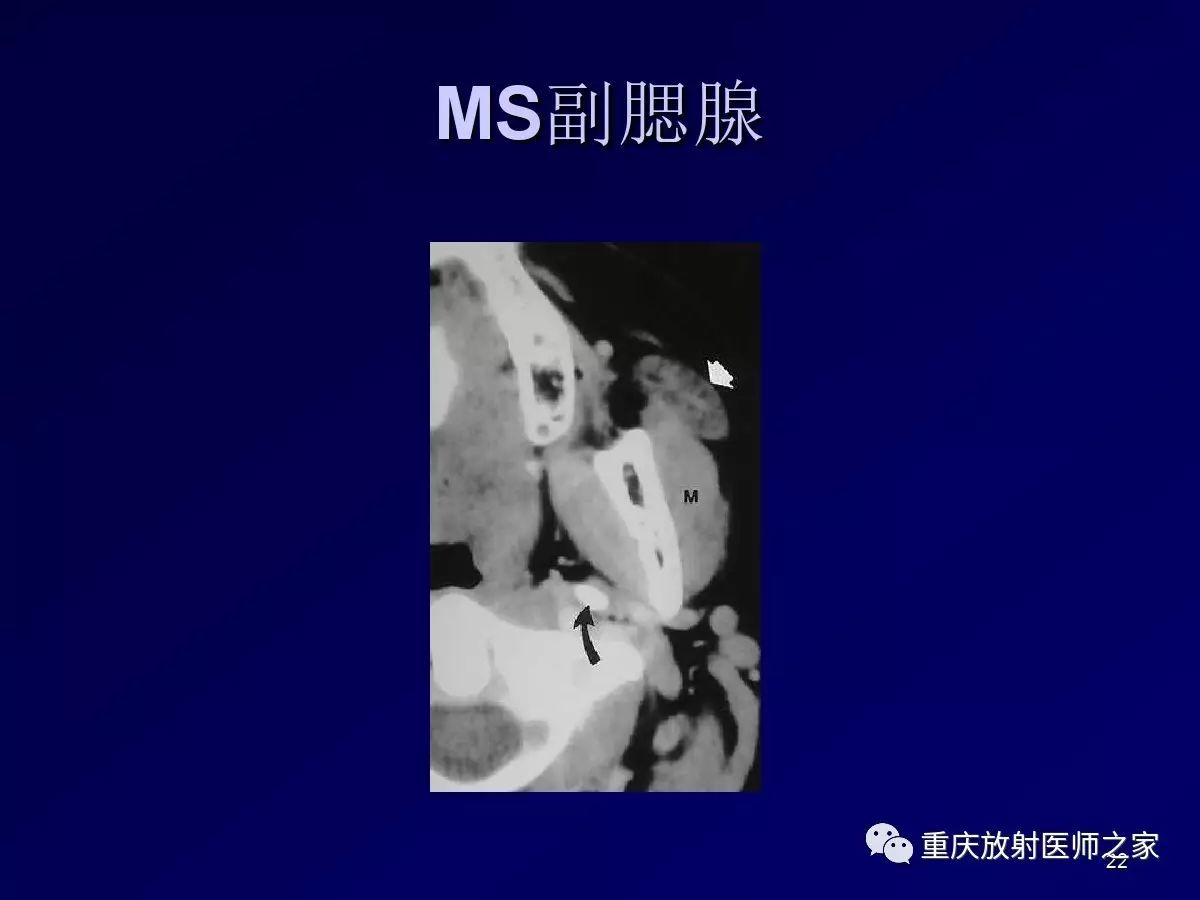 影像PPT - 【PPT】颈部病变的诊断思路-22