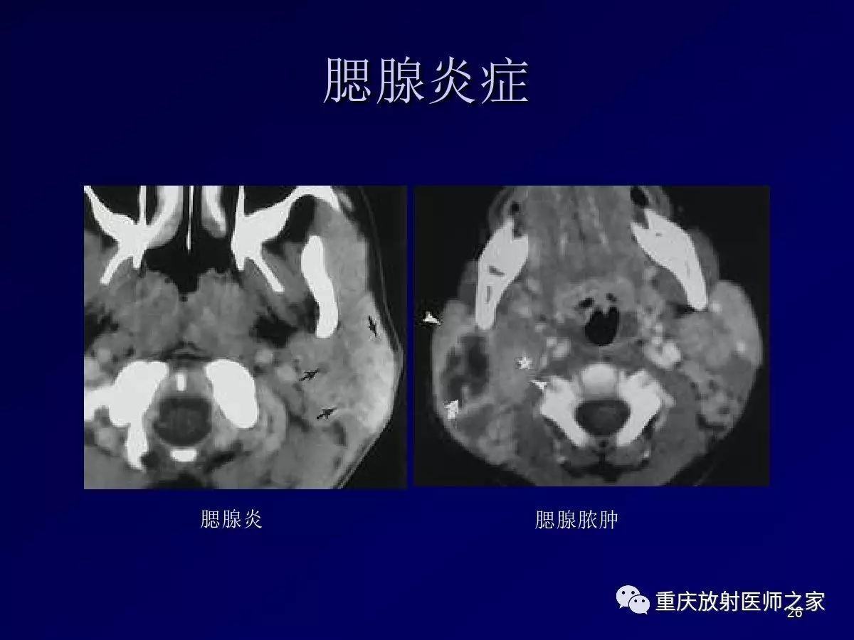 影像PPT - 【PPT】颈部病变的诊断思路-26