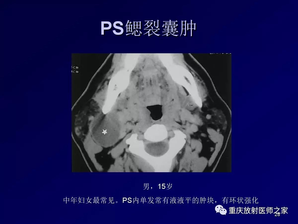影像PPT - 【PPT】颈部病变的诊断思路-28