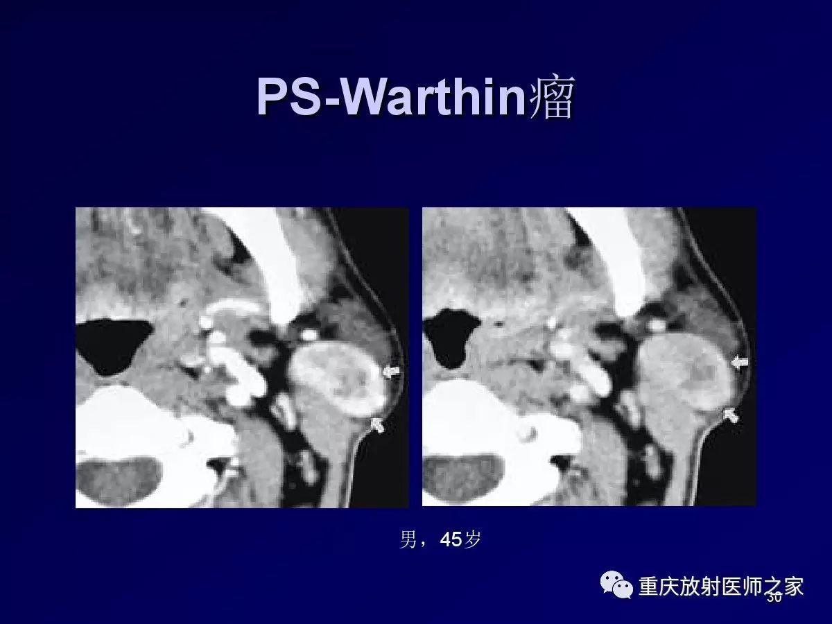 影像PPT - 【PPT】颈部病变的诊断思路-30