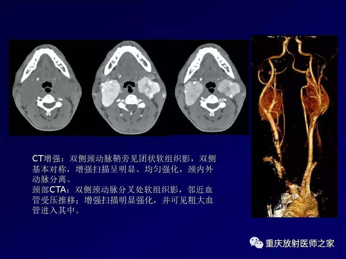 影像PPT - 【PPT】颈部病变的诊断思路-35