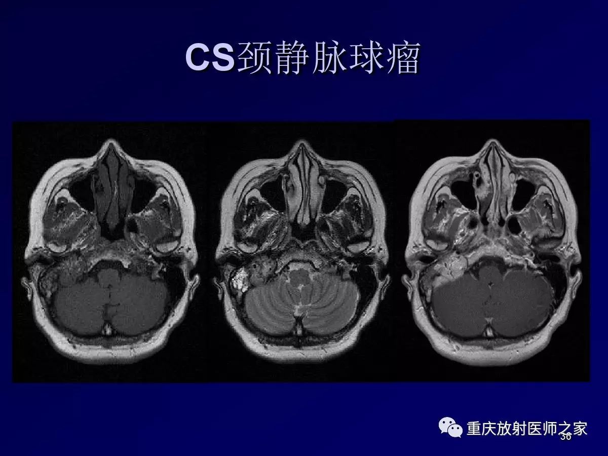 影像PPT - 【PPT】颈部病变的诊断思路-36