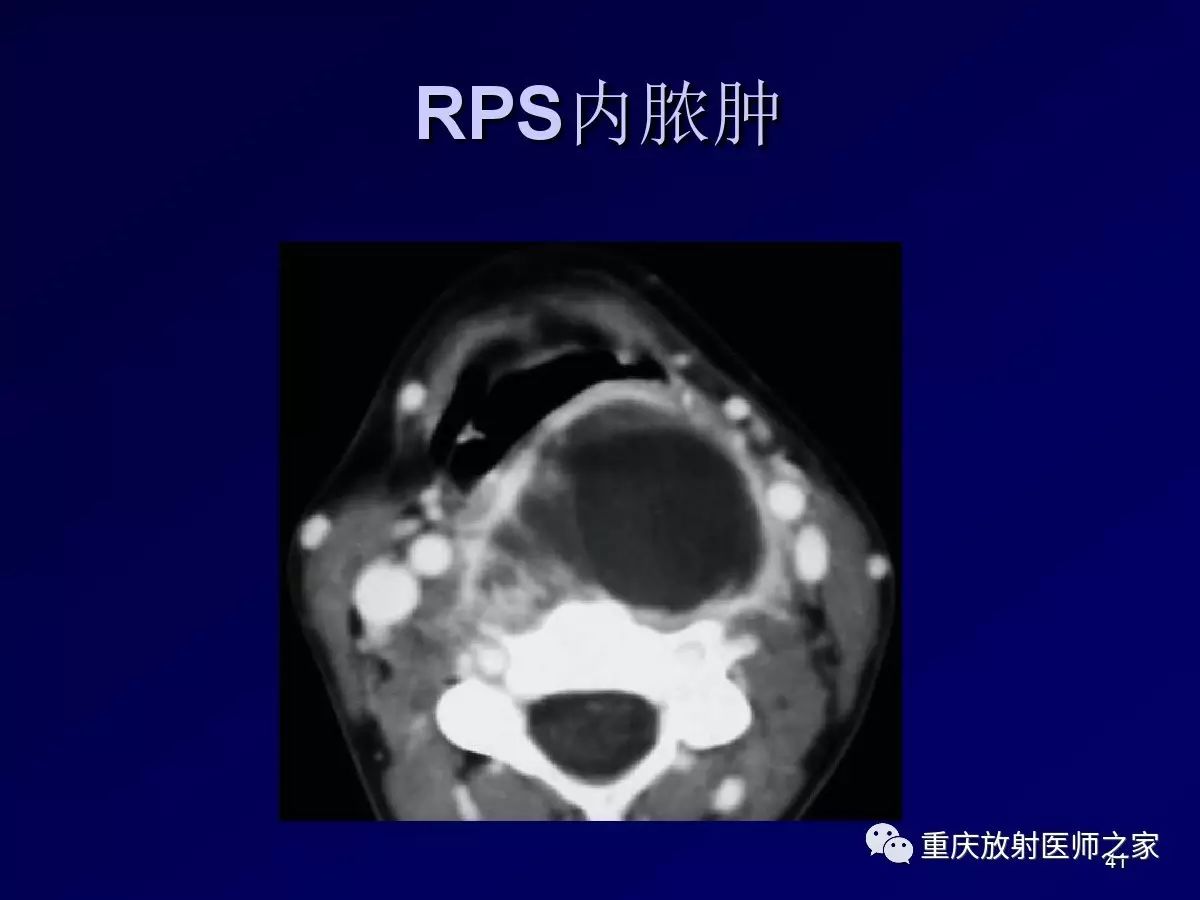 影像PPT - 【PPT】颈部病变的诊断思路-41