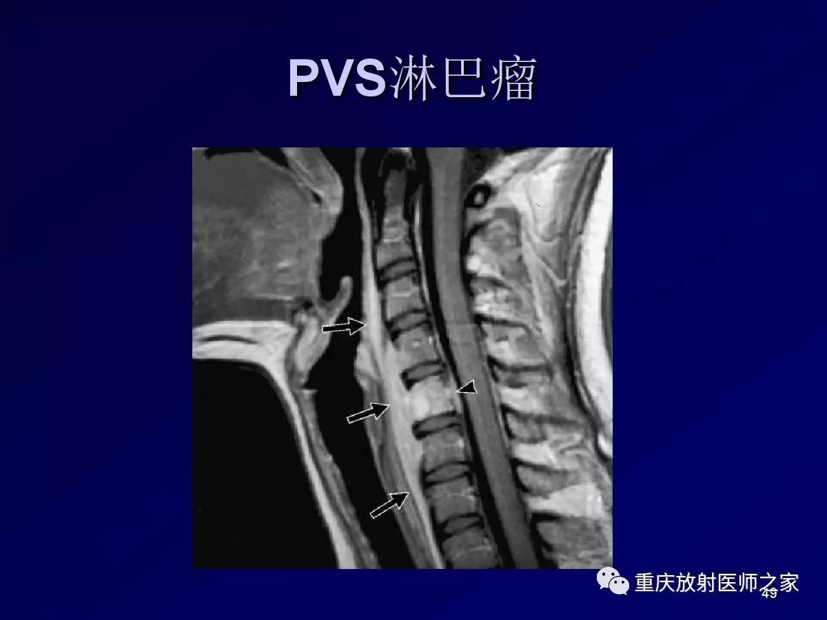影像PPT - 【PPT】颈部病变的诊断思路-49