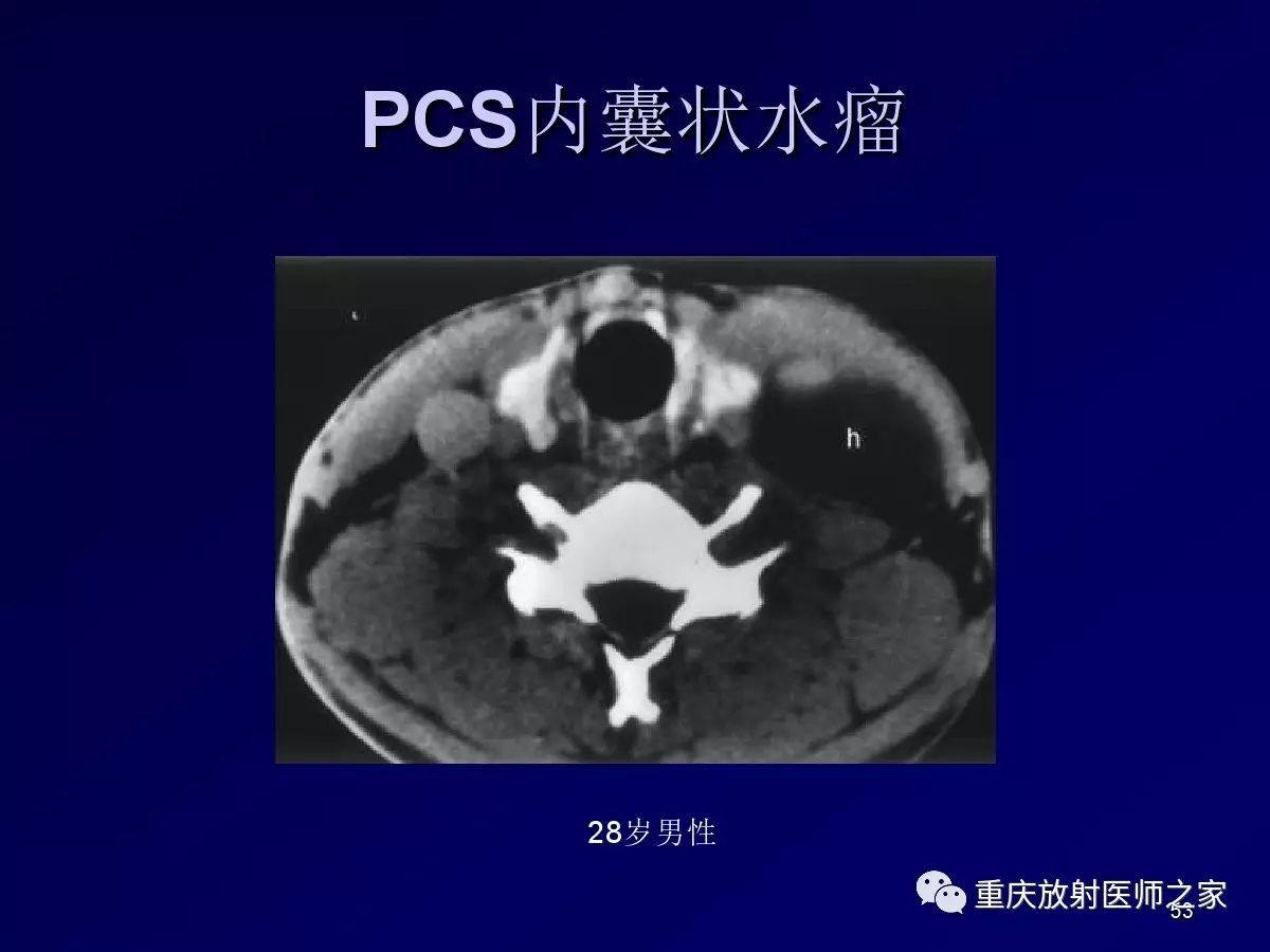 影像PPT - 【PPT】颈部病变的诊断思路-53