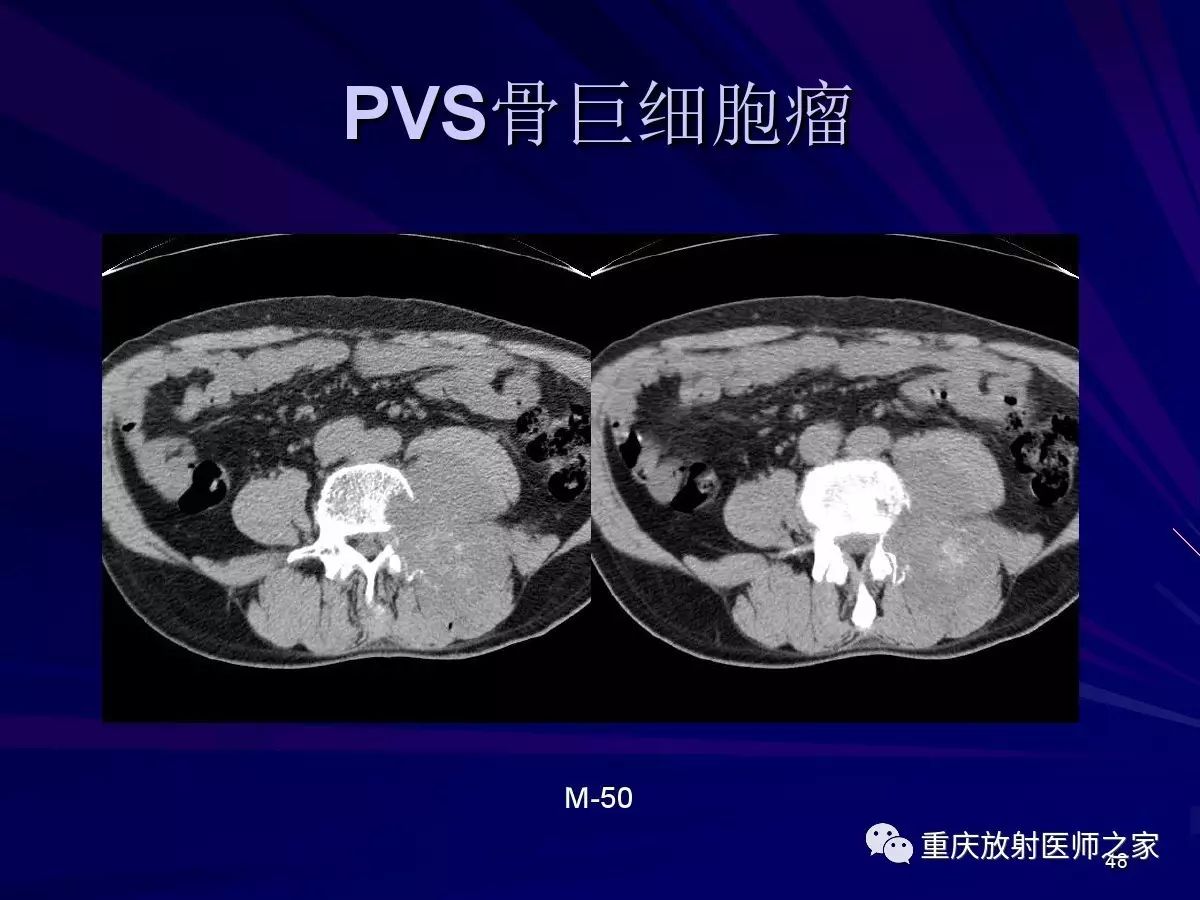 影像PPT - 【PPT】颈部病变的诊断思路-48