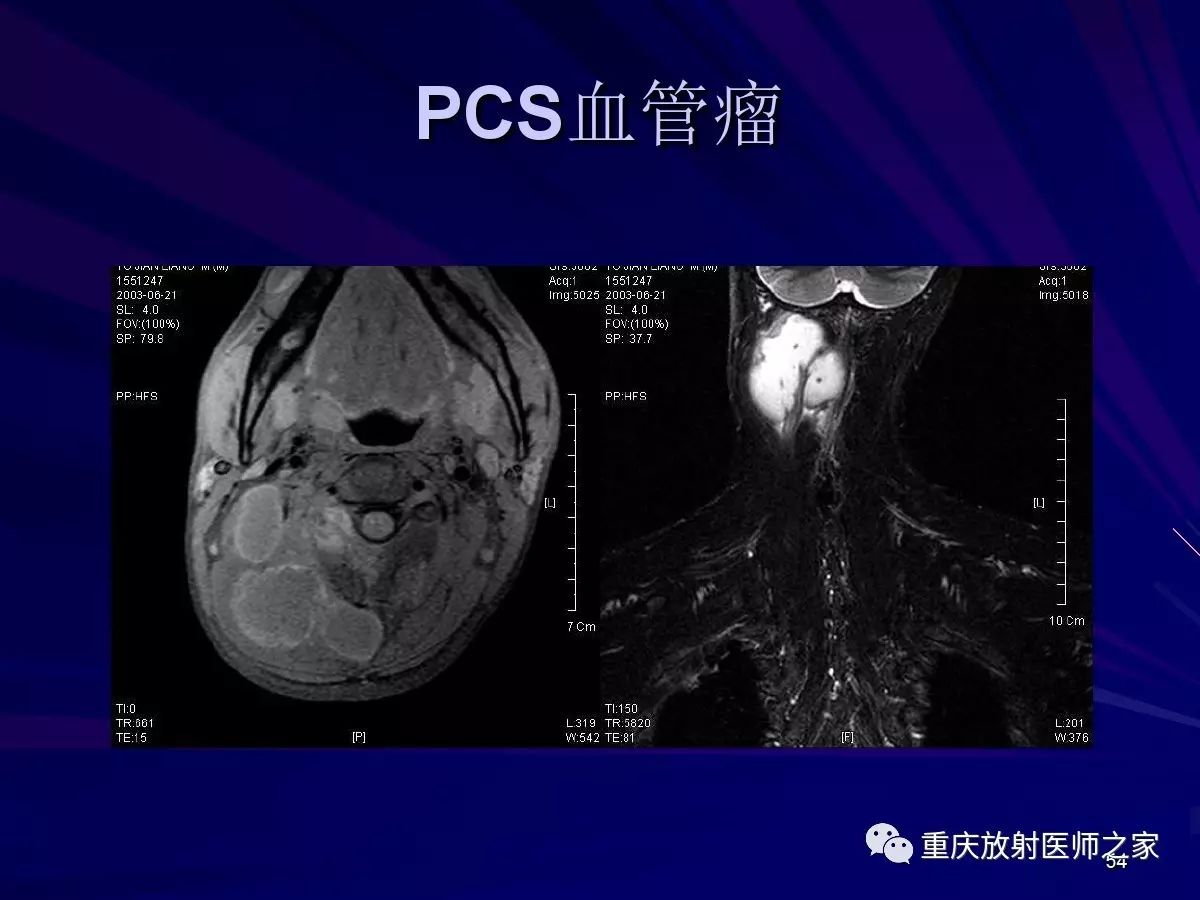 影像PPT - 【PPT】颈部病变的诊断思路-54