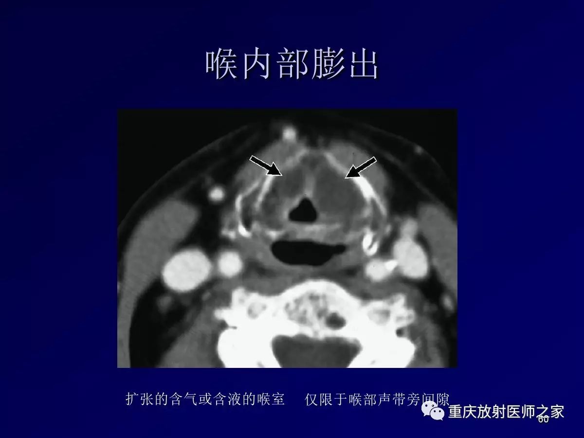 影像PPT - 【PPT】颈部病变的诊断思路-60