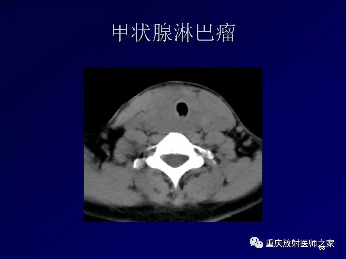影像PPT - 【PPT】颈部病变的诊断思路-68