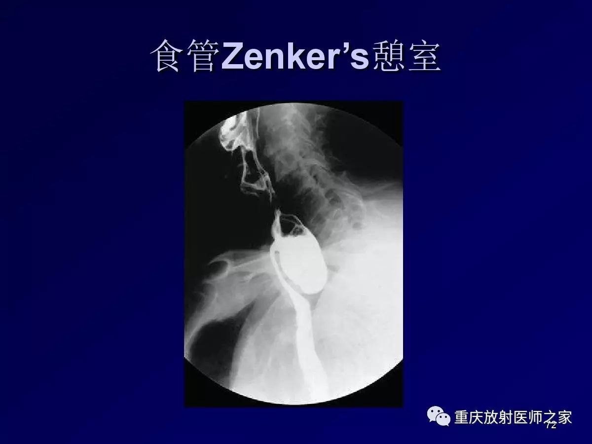 影像PPT - 【PPT】颈部病变的诊断思路-72