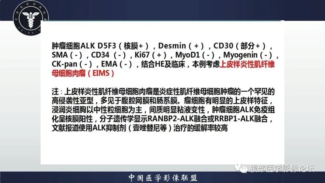 影像PPT - 【病例】上皮样炎性肌纤维母细胞肉瘤1例影像表现-9