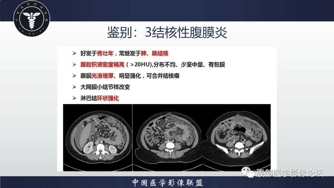 影像PPT - 【病例】上皮样炎性肌纤维母细胞肉瘤1例影像表现-17