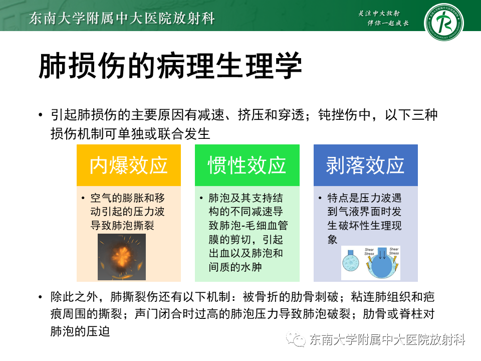 影像PPT - 【PPT】胸部外伤的影像学表现-7