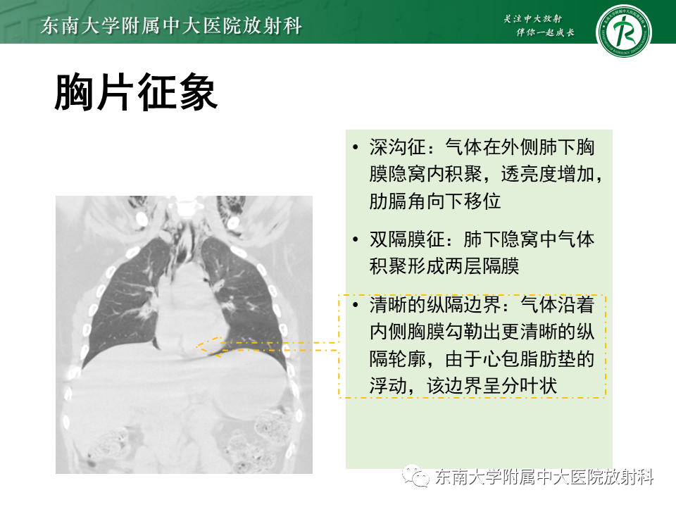 影像PPT - 【PPT】胸部外伤的影像学表现-31