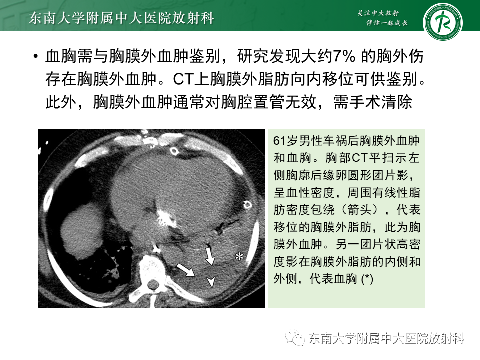影像PPT - 【PPT】胸部外伤的影像学表现-37