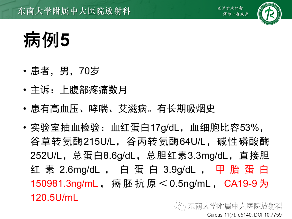影像PPT - 【PPT】胆囊癌-45 影像PPT - 【PPT】胆囊癌-45