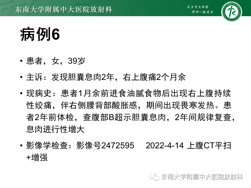 影像PPT - 【PPT】胆囊癌-50 影像PPT - 【PPT】胆囊癌-50