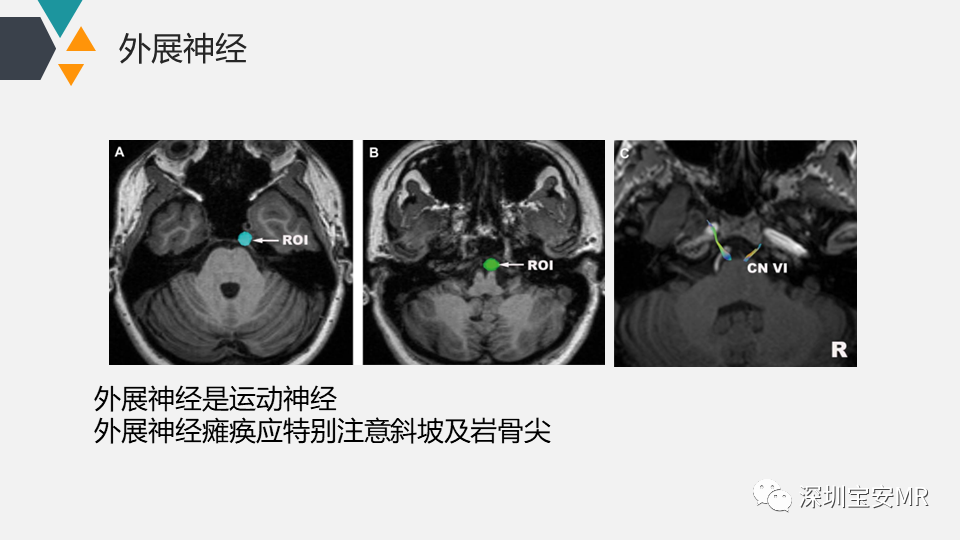 影像PPT - 【PPT】脑神经影像学与相关病变-25