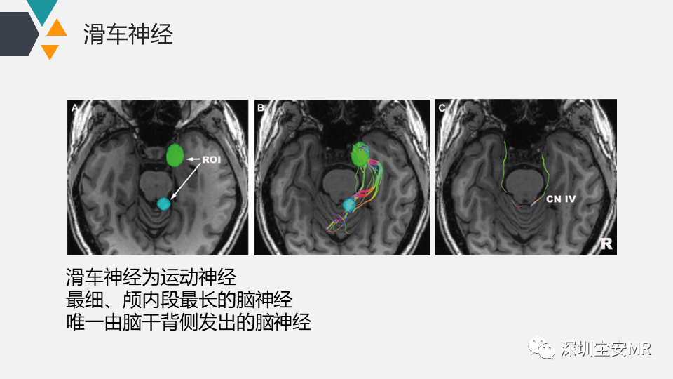 影像PPT - 【PPT】脑神经影像学与相关病变-23