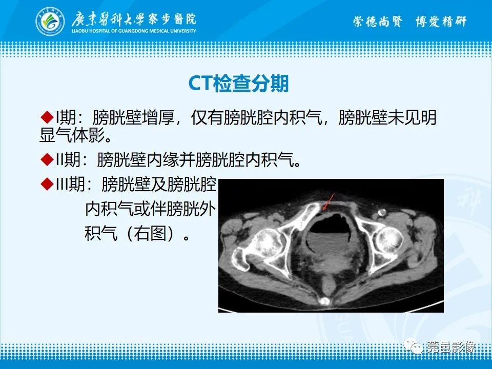 影像PPT - 【PPT】气肿性膀胱炎CT表现-16