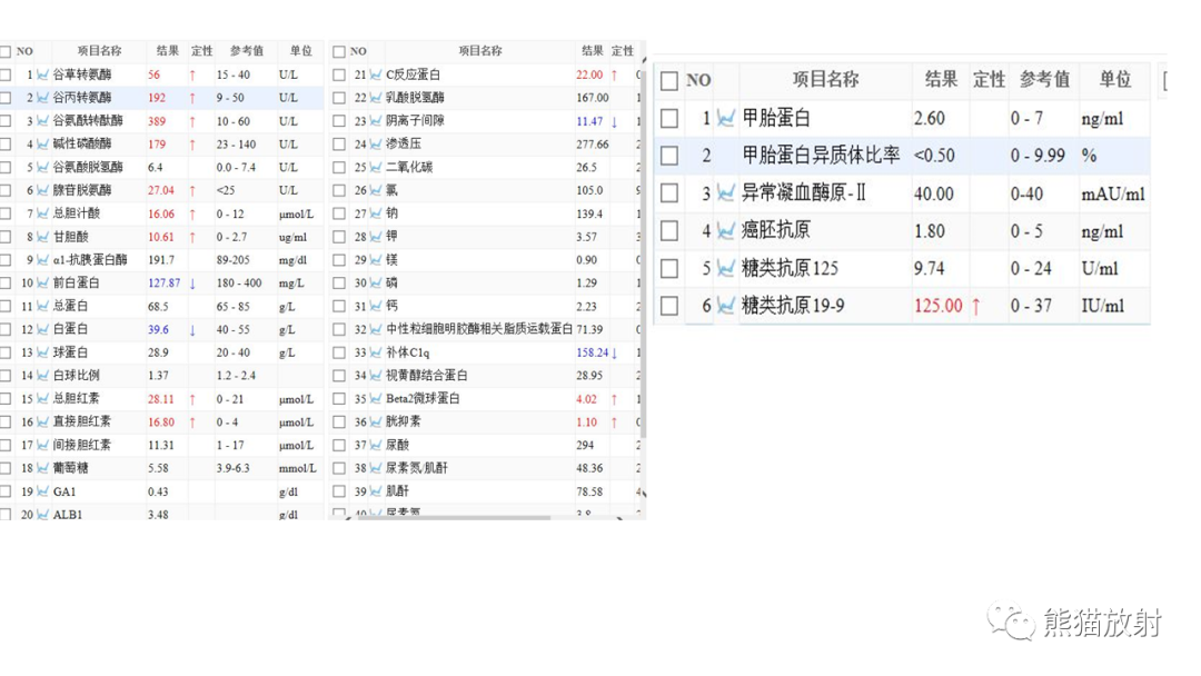 影像PPT - 【病例】黄色肉芽肿性胆囊炎 VS 胆囊癌-4