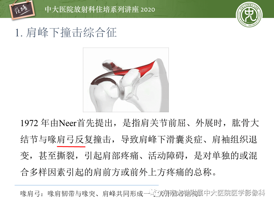 影像PPT - 【PPT】常见撞击综合征的影像诊断-3