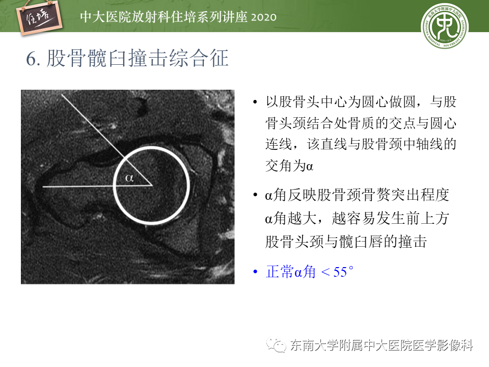 影像PPT - 【PPT】常见撞击综合征的影像诊断-33