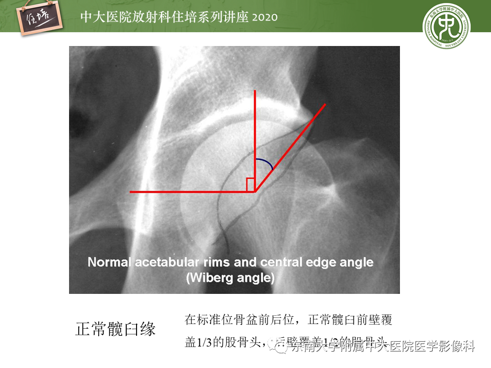 影像PPT - 【PPT】常见撞击综合征的影像诊断-38