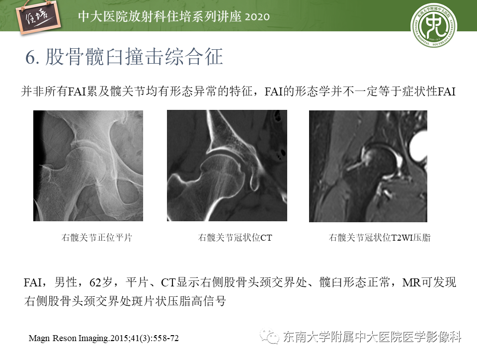 影像PPT - 【PPT】常见撞击综合征的影像诊断-43
