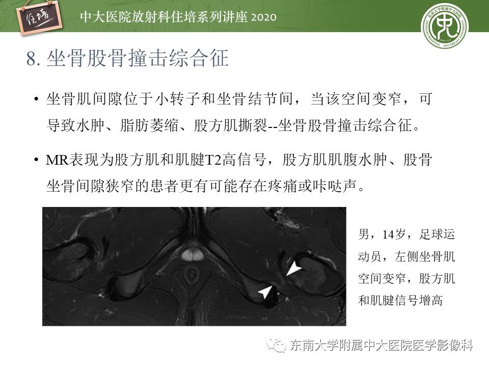 影像PPT - 【PPT】常见撞击综合征的影像诊断-46