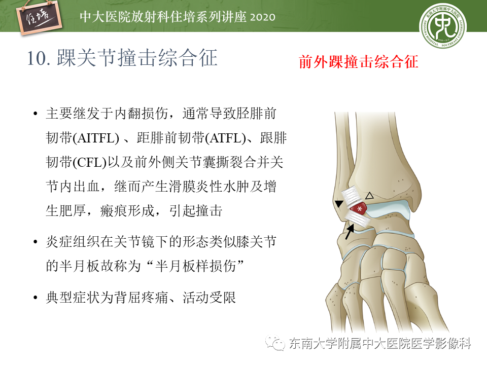 影像PPT - 【PPT】常见撞击综合征的影像诊断-51