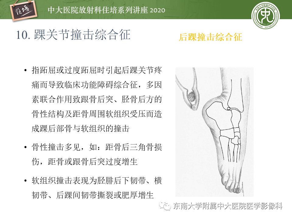 影像PPT - 【PPT】常见撞击综合征的影像诊断-60