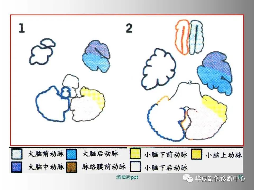影像PPT - 【PPT】脑卒中影像诊断-39