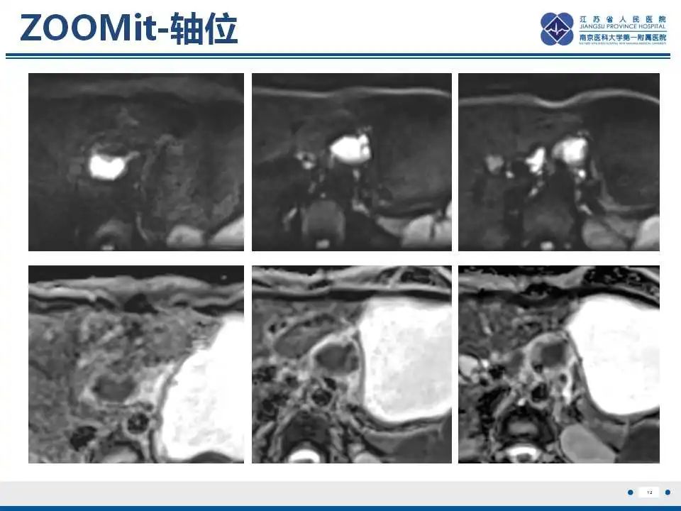 影像PPT - 【PPT】原发灶不明转移癌-13