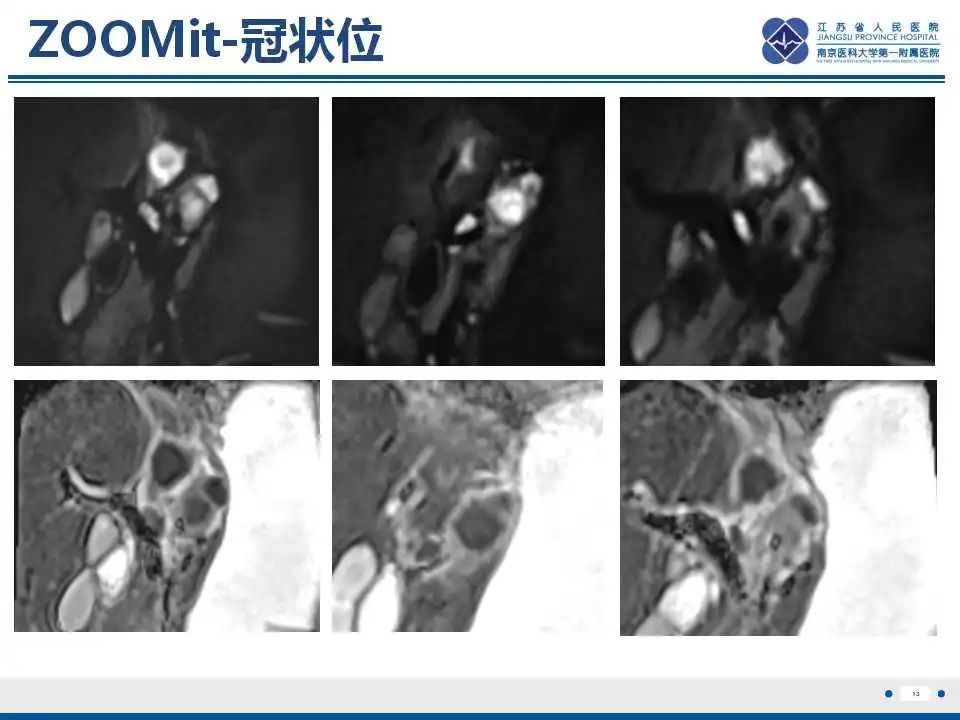影像PPT - 【PPT】原发灶不明转移癌-14