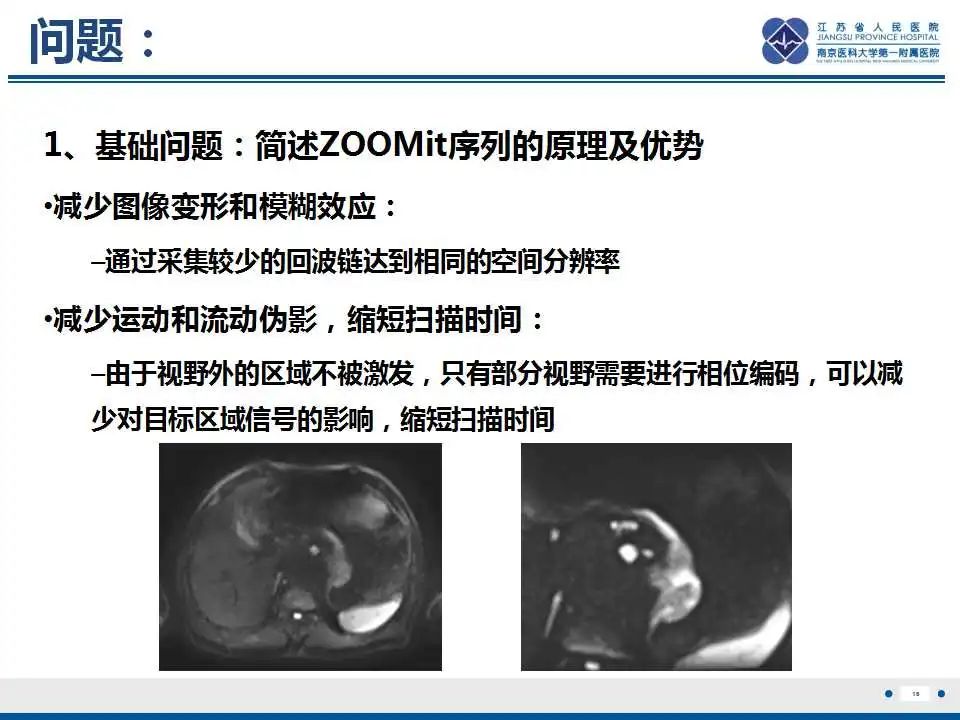 影像PPT - 【PPT】原发灶不明转移癌-17