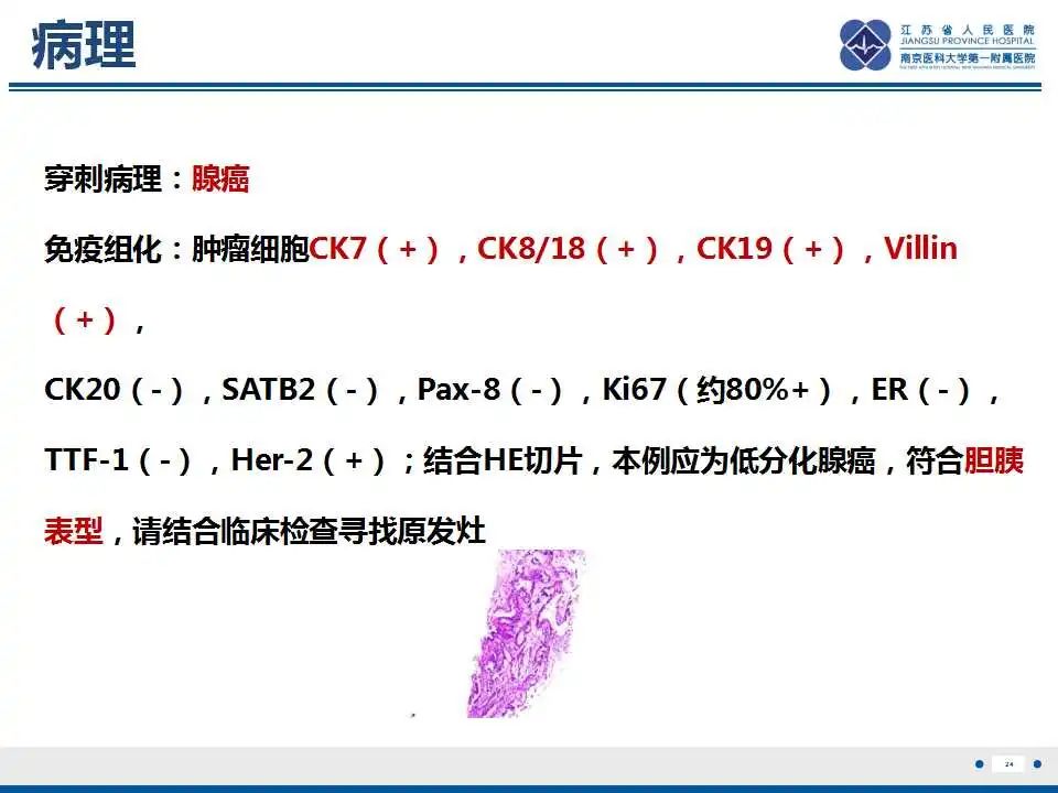 影像PPT - 【PPT】原发灶不明转移癌-25