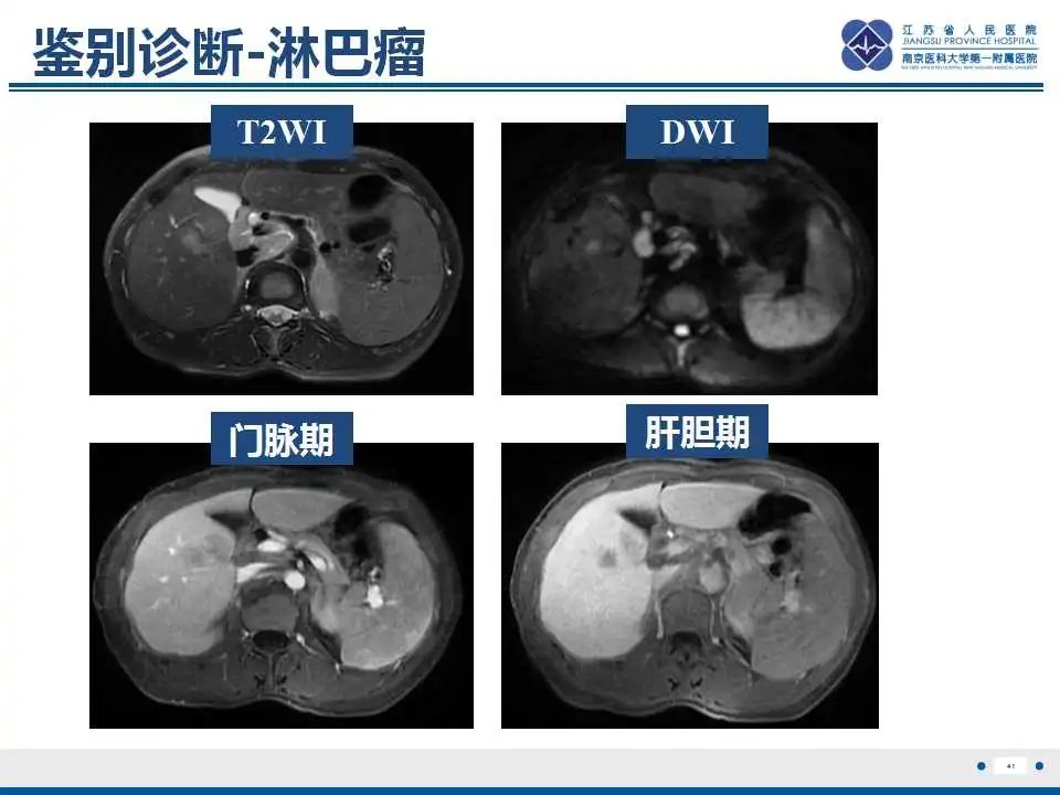 影像PPT - 【PPT】原发灶不明转移癌-42