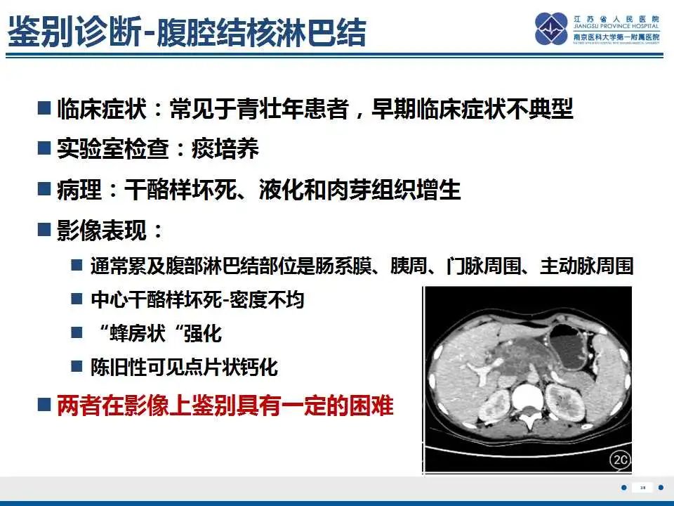 影像PPT - 【PPT】原发灶不明转移癌-39