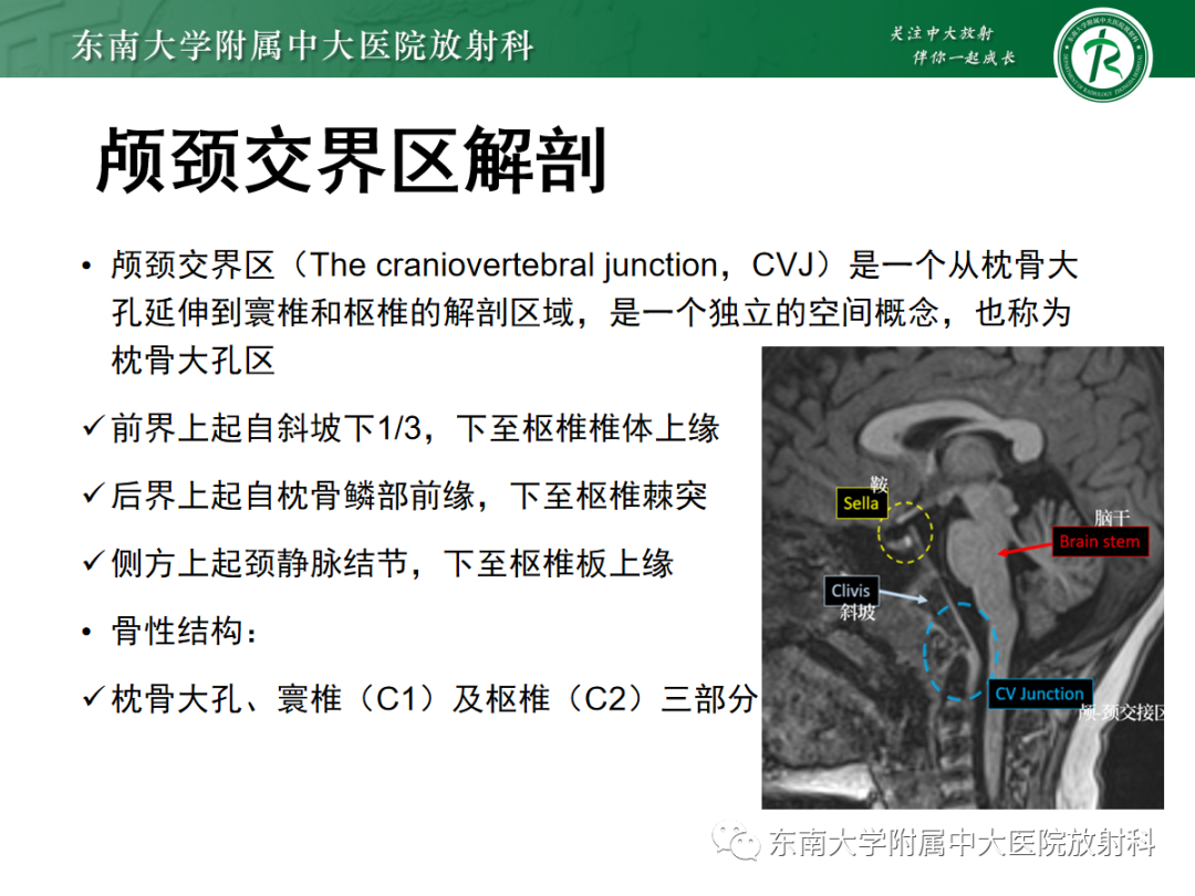 影像PPT - 【PPT】颅颈交界区占位病例随诊-11