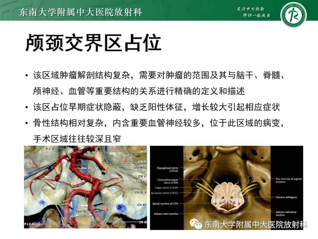 影像PPT - 【PPT】颅颈交界区占位病例随诊-12