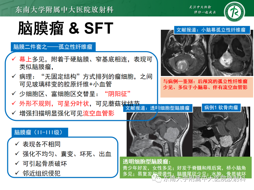 影像PPT - 【PPT】颅颈交界区占位病例随诊-17