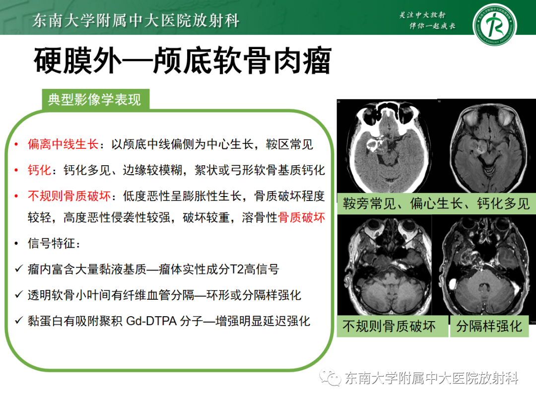 影像PPT - 【PPT】颅颈交界区占位病例随诊-21