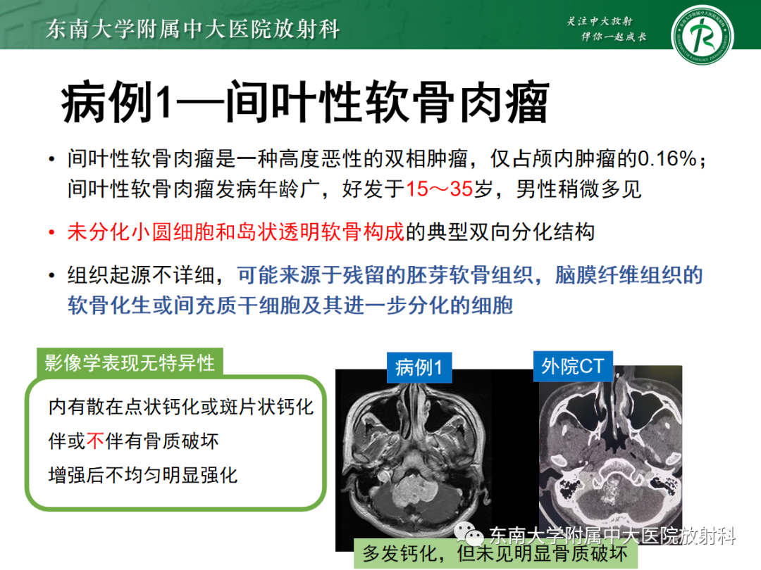 影像PPT - 【PPT】颅颈交界区占位病例随诊-22