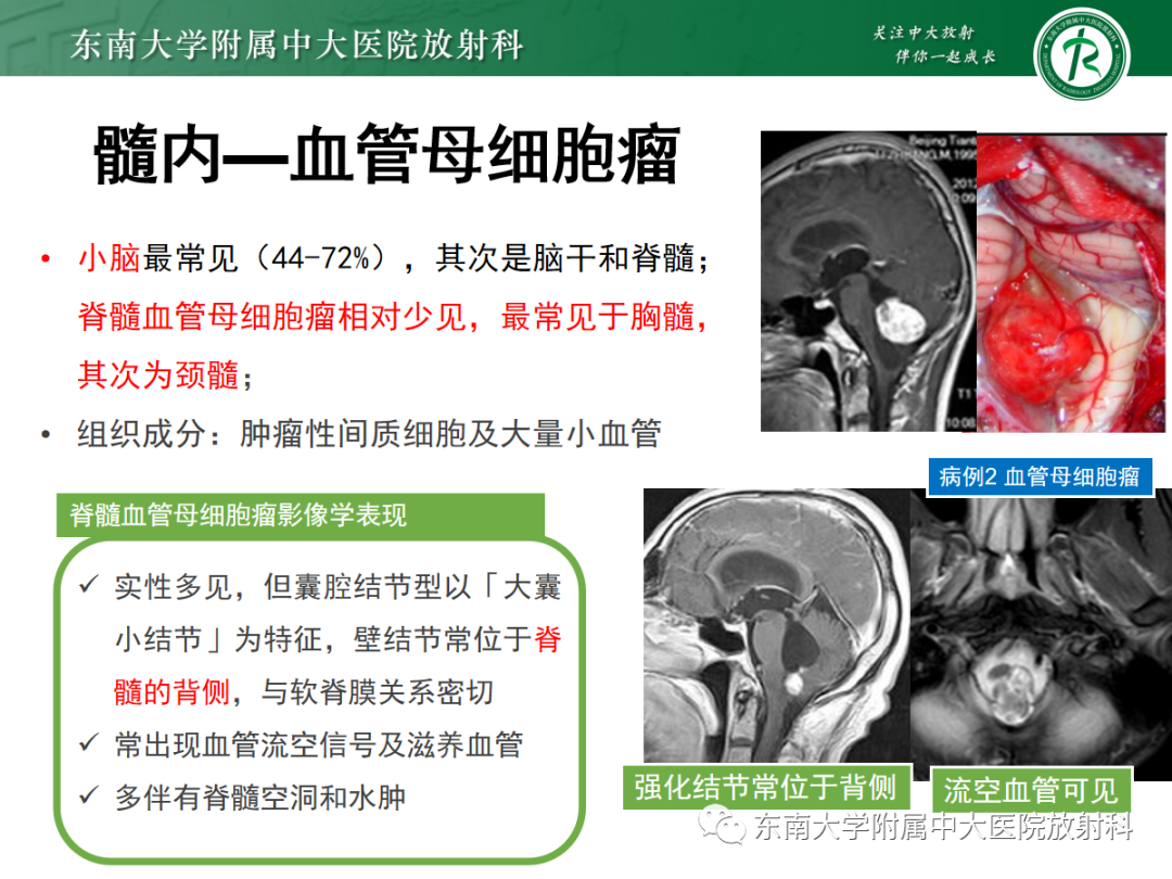 影像PPT - 【PPT】颅颈交界区占位病例随诊-26